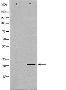 GLO1 / Glyoxalase I Antibody - Western blot analysis of HeLa whole cells lysates using GLO1 antibody. The lane on the left is treated with the antigen-specific peptide.