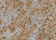 GLO1 / Glyoxalase I Antibody - 1:100 staining human kidney tissue by IHC-P. The sample was formaldehyde fixed and a heat mediated antigen retrieval step in citrate buffer was performed. The sample was then blocked and incubated with the antibody for 1.5 hours at 22°C. An HRP conjugated goat anti-rabbit antibody was used as the secondary.
