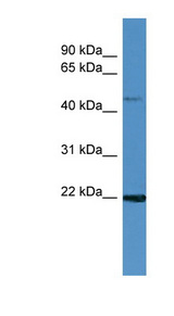 GLOD2 / MCEE Antibody - MCEE antibody Western blot of Fetal Brain lysate.  This image was taken for the unconjugated form of this product. Other forms have not been tested.