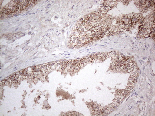 GLOD2 / MCEE Antibody - Immunohistochemical staining of paraffin-embedded Human prostate tissue within the normal limits using anti-MCEE mouse monoclonal antibody. (Heat-induced epitope retrieval by 1mM EDTA in 10mM Tris buffer. (pH8.5) at 120°C for 3 min. (1:150)