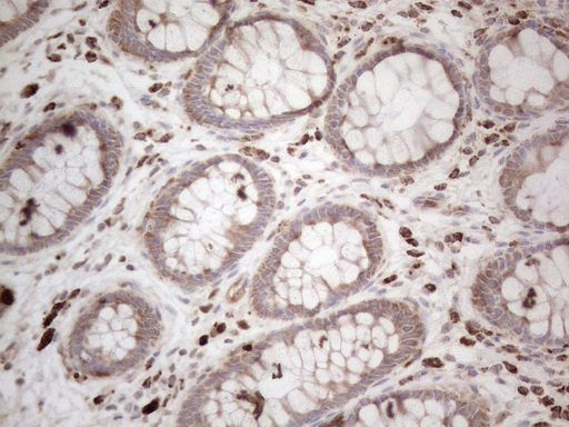 GLOD2 / MCEE Antibody - Immunohistochemical staining of paraffin-embedded Human colon tissue within the normal limits using anti-MCEE mouse monoclonal antibody. (Heat-induced epitope retrieval by 1mM EDTA in 10mM Tris buffer. (pH8.5) at 120°C for 3 min. (1:150)