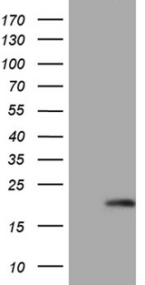 GLOD2 / MCEE Antibody - HEK293T cells were transfected with the pCMV6-ENTRY control. (Left lane) or pCMV6-ENTRY MCEE. (Right lane) cDNA for 48 hrs and lysed. Equivalent amounts of cell lysates. (5 ug per lane) were separated by SDS-PAGE and immunoblotted with anti-MCEE. (1:500)