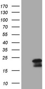 GLOD2 / MCEE Antibody - HEK293T cells were transfected with the pCMV6-ENTRY control. (Left lane) or pCMV6-ENTRY MCEE. (Right lane) cDNA for 48 hrs and lysed. Equivalent amounts of cell lysates. (5 ug per lane) were separated by SDS-PAGE and immunoblotted with anti-MCEE. (1:2000)