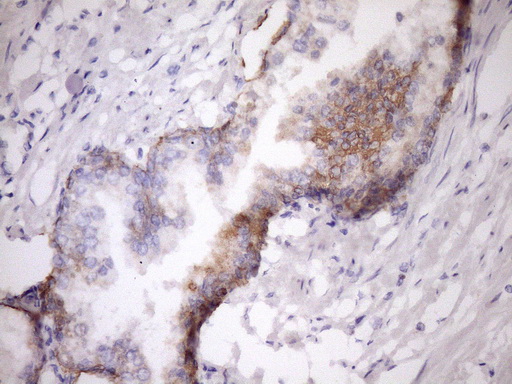 GLOD2 / MCEE Antibody - Immunohistochemical staining of paraffin-embedded Human prostate tissue within the normal limits using anti-MCEE mouse monoclonal antibody. (Heat-induced epitope retrieval by Tris-EDTA, pH8.0)(1:150)