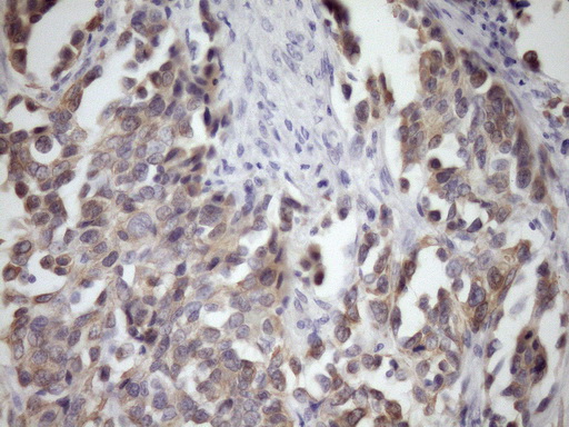 GLOD2 / MCEE Antibody - Immunohistochemical staining of paraffin-embedded Human bladder tissue within the normal limits using anti-MCEE mouse monoclonal antibody. (Heat-induced epitope retrieval by Tris-EDTA, pH8.0)(1:150)