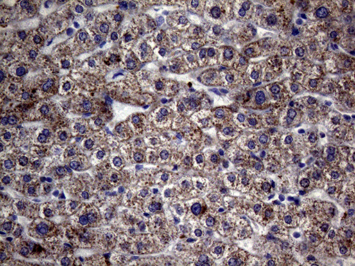 GLOD2 / MCEE Antibody - Immunohistochemical staining of paraffin-embedded Human liver tissue within the normal limits using anti-MCEE mouse monoclonal antibody. (Heat-induced epitope retrieval by 1mM EDTA in 10mM Tris buffer. (pH8.5) at 120°C for 3 min. (1:2000)