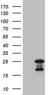 GLOD2 / MCEE Antibody - HEK293T cells were transfected with the pCMV6-ENTRY control. (Left lane) or pCMV6-ENTRY MCEE. (Right lane) cDNA for 48 hrs and lysed