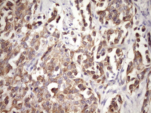 GLOD2 / MCEE Antibody - Immunohistochemical staining of paraffin-embedded Human bladder tissue within the normal limits using anti-MCEE mouse monoclonal antibody. (Heat-induced epitope retrieval by Tris-EDTA, pH8.0)(1:150)