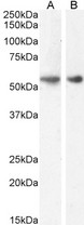 GLP1R / GLP-1 Receptor Antibody - GLP1R / GLP-1 Receptor antibody (1µg/ml) staining of Rat (A) and (0.1ug/ml) Pig (B) Brain lysate (35µg protein in RIPA buffer). Detected by chemiluminescence.