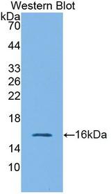 GLP1R / GLP-1 Receptor Antibody - Western blot of GLP1R / GLP-1 Receptor antibody.