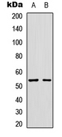 GLP1R / GLP-1 Receptor Antibody - Western blot analysis of GLP-1 Receptor expression in SKNSH (A); HUVEC (B) whole cell lysates.