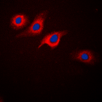 GLP1R / GLP-1 Receptor Antibody - Immunofluorescent analysis of GLP-1 Receptor staining in SKNSH cells. Formalin-fixed cells were permeabilized with 0.1% Triton X-100 in TBS for 5-10 minutes and blocked with 3% BSA-PBS for 30 minutes at room temperature. Cells were probed with the primary antibody in 3% BSA-PBS and incubated overnight at 4 deg C in a humidified chamber. Cells were washed with PBST and incubated with a DyLight 594-conjugated secondary antibody (red) in PBS at room temperature in the dark. DAPI was used to stain the cell nuclei (blue).
