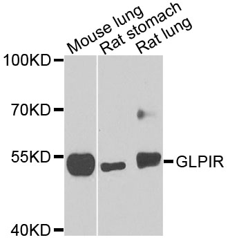 GLP1R / GLP-1 Receptor Antibody - Western blot analysis of extracts of various cells.