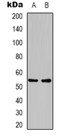 GLP1R / GLP-1 Receptor Antibody - Western blot analysis of GLP-1 Receptor expression in mouse brain (A); rat brain (B) whole cell lysates.
