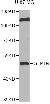 GLP1R / GLP-1 Receptor Antibody - Western blot analysis of extracts of U-87MG cells, using GLP1R antibody at 1:1000 dilution. The secondary antibody used was an HRP Goat Anti-Rabbit IgG (H+L) at 1:10000 dilution. Lysates were loaded 25ug per lane and 3% nonfat dry milk in TBST was used for blocking. An ECL Kit was used for detection and the exposure time was 60s.