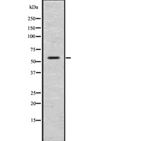 GLP1R / GLP-1 Receptor Antibody - Western blot analysis of GLP1R using COLO205 whole lysates.