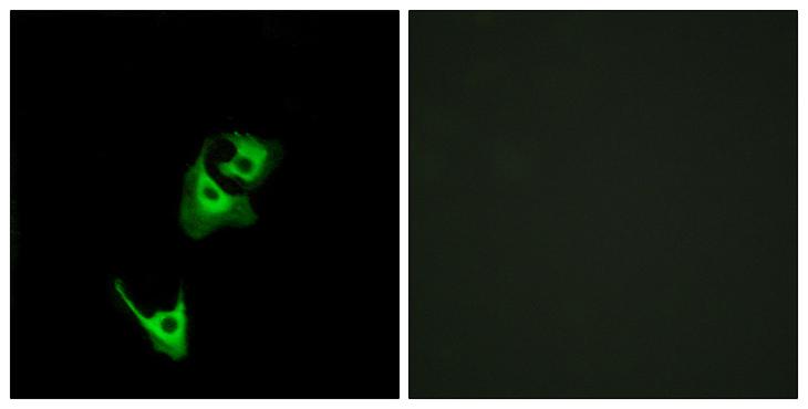GLP1R / GLP-1 Receptor Antibody - Peptide - + Immunofluorescence analysis of HeLa cells, using GLP1R antibody.