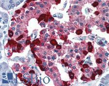 GLP2 Antibody - Human Pancreas: Formalin-Fixed, Paraffin-Embedded (FFPE)