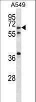 GLP2R Antibody - GLP2R Antibody western blot of A549 cell line lysates (35 ug/lane). The GLP2R antibody detected the GLP2R protein (arrow).