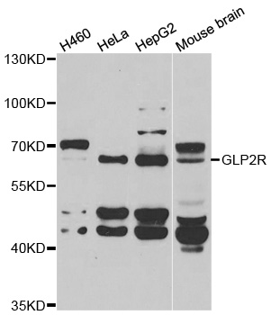 GLP2R Antibody - Western blot analysis of extracts of various cell lines.