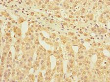 GLP2R Antibody - Immunohistochemistry of paraffin-embedded human adrenal gland tissue at dilution 1:100