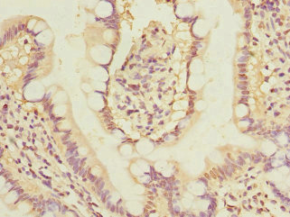 GLP2R Antibody - Immunohistochemistry of paraffin-embedded human small intestine at dilution 1:100