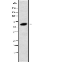 GLP2R Antibody - Western blot analysis GLP2R using 293 whole cells lysates