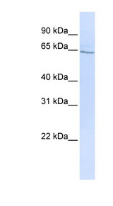 GLP2R Antibody - GLP2R antibody Western blot of HepG2 cell lysate. This image was taken for the unconjugated form of this product. Other forms have not been tested.