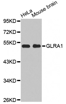 GLRA1/Glycine Receptor Alpha 1 Antibody - Western blot analysis of extracts of various cell lines, using GLRA1 antibody. (1: HeLa cell lysate 2: Mouse brain tissue lysate).