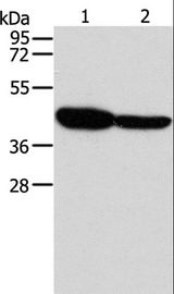 GLRA1/Glycine Receptor Alpha 1 Antibody - Western blot analysis of Mouse brain and Human fetal brain tissue, using GLRA1 Polyclonal Antibody at dilution of 1:500.