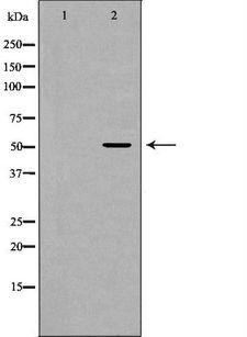 GLRA1/Glycine Receptor Alpha 1 Antibody - Western blot analysis of mouse brain lysate using GLRA1 antibody. The lane on the left is treated with the antigen-specific peptide.