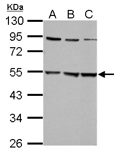 GLRA2 Antibody - Sample (30 ug of whole cell lysate). A:293T, B: A431, C: HepG2. 10% SDS PAGE. GLRA2 antibody diluted at 1:5000.