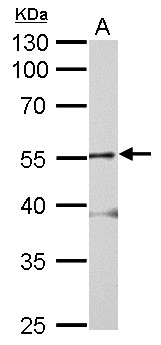 GLRA2 Antibody - Glycine Receptor alpha 2 antibody detects GLRA2 protein by Western blot analysis. A. 50 ug mouse brain lysate/extract. 10 % SDS-PAGE. Glycine Receptor alpha 2 antibody dilution:1:2000