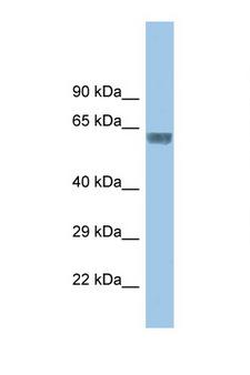 GLRA3 Antibody - GLRA3 antibody Western blot of Small Intestine lysate. Antibody concentration 1 ug/ml.  This image was taken for the unconjugated form of this product. Other forms have not been tested.