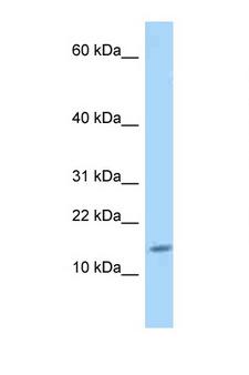 GLRX / Glutaredoxin Antibody - GLRX / Glutaredoxin 1 antibody Western blot of Rat Lung lysate. Antibody concentration 1 ug/ml.  This image was taken for the unconjugated form of this product. Other forms have not been tested.