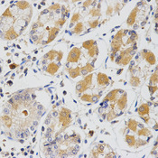 GLRX / Glutaredoxin Antibody - Immunohistochemistry of paraffin-embedded human stomach using GLRX antibody at dilution of 1:200 (x400 lens).