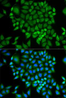 GLRX / Glutaredoxin Antibody - Immunofluorescence analysis of MCF-7 cell using GLRX antibody. Blue: DAPI for nuclear staining.