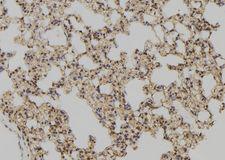 GLRX / Glutaredoxin Antibody - 1:100 staining rat lung tissue by IHC-P. The sample was formaldehyde fixed and a heat mediated antigen retrieval step in citrate buffer was performed. The sample was then blocked and incubated with the antibody for 1.5 hours at 22°C. An HRP conjugated goat anti-rabbit antibody was used as the secondary.