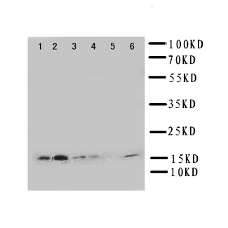 GLRX2 / Glutaredoxin 2 Antibody - WB of GLRX2 / Glutaredoxin 2 antibody. Lane 1: Rat Testis Tissue Lysate. Lane 2: HELA Cell Lysate. Lane 3: U87 Cell Lysate. Lane 4: NEU Cell Lysate. Lane 5: JURKAT Cell Lysate. Lane 6: MCF-7 Cell Lysate.