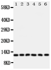 GLRX2 / Glutaredoxin 2 Antibody - Anti-Glutaredoxin 2 antibody, Western blotting Lane 1: Rat Testis Tissue LysateLane 2: HELA Cell LysateLane 3: U87 Cell LysateLane 4: NEU Cell LysateLane 5: JURKAT Cell LysateLane 6: MCF-7 Cell Lysate