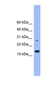 GLRX2 / Glutaredoxin 2 Antibody - GLRX2 antibody Western blot of Fetal Heart lysate. This image was taken for the unconjugated form of this product. Other forms have not been tested.