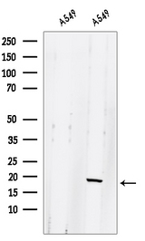 GLRX2 / Glutaredoxin 2 Antibody - Western blot analysis of extracts of A549 cells using GLRX2 antibody. The lane on the left was treated with blocking peptide.