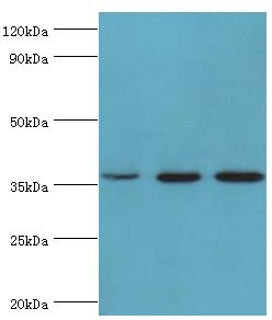 GLRX3 / Glutaredoxin 3 Antibody - Western blot. All lanes: Glutaredoxin-3 antibody at 10 ug/ml. Lane 1: rat brain tissue. Lane 2: HepG2 whole cell lysate. Lane 3: HeLa whole cell lysate. Secondary antibody: Goat polyclonal to rabbit at 1:10000 dilution. Predicted band size: 37 kDa. Observed band size: 37 kDa.
