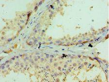 GLRX3 / Glutaredoxin 3 Antibody - Immunohistochemistry of paraffin-embedded human testicle using antibody at 1:100 dilution.