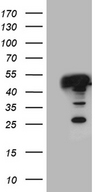GLRX3 / Glutaredoxin 3 Antibody - HEK293T cells were transfected with the pCMV6-ENTRY control. (Left lane) or pCMV6-ENTRY GLRX3. (Right lane) cDNA for 48 hrs and lysed. Equivalent amounts of cell lysates. (5 ug per lane) were separated by SDS-PAGE and immunoblotted with anti-GLRX3. (1:2000)