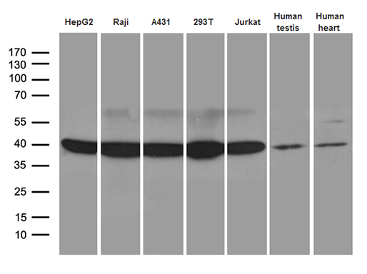 GLRX3 / Glutaredoxin 3 Antibody - Western blot analysis of extracts. (35ug) from 5 different cell lines and 2 different tissue lysates by using anti-GLRX3 monoclonal antibody. (1:500)