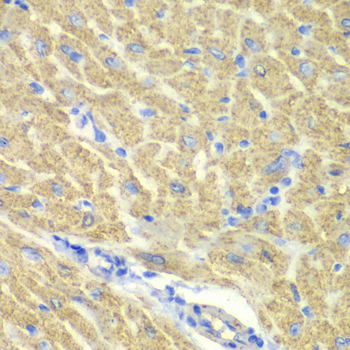 GLRX3 / Glutaredoxin 3 Antibody - Immunohistochemistry of paraffin-embedded mouse heart.