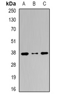 GLRX3 / Glutaredoxin 3 Antibody - Western blot analysis of PICOT expression in MCF7 (A); A431 (B); HeLa (C) whole cell lysates.