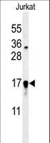 GLRX5 / Glutaredoxin 5 Antibody - Western blot of GLRX5 Antibody in Jurkat cell line lysates (35 ug/lane). GLRX5 (arrow) was detected using the purified antibody.