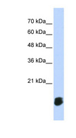 GLRX5 / Glutaredoxin 5 Antibody - GLRX5 antibody Western blot of Transfected 293T cell lysate. This image was taken for the unconjugated form of this product. Other forms have not been tested.